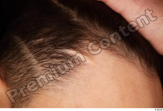 Danior head scar 0001.jpg